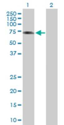 Western Blot: ALS2CR15 Antibody [H00130026-B01P]