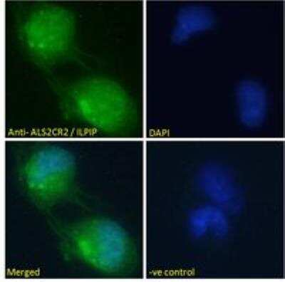 Immunocytochemistry/ Immunofluorescence: ALS2CR2 Antibody [NB100-1181]