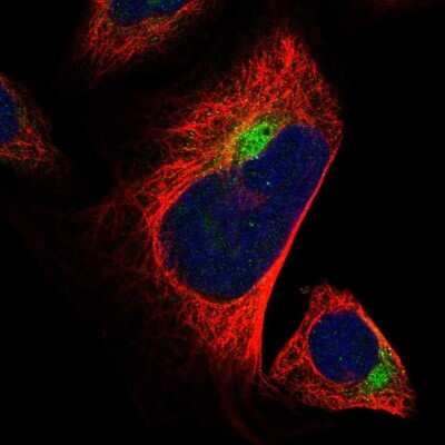 Immunocytochemistry/ Immunofluorescence: ALS2CR2 Antibody [NBP1-90183]