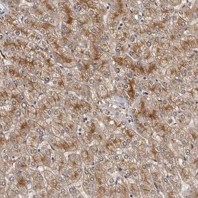 Immunohistochemistry-Paraffin: ALS2CR2 Antibody [NBP1-90184]