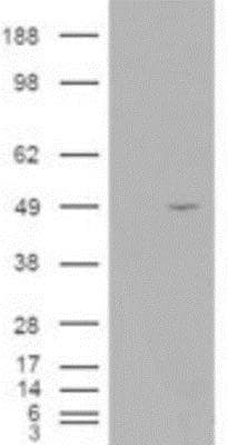 Western Blot: ALS2CR2 Antibody [NB100-1181]