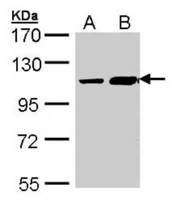 Western Blot: ALS2CR3 Antibody [NBP1-31056]