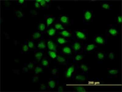 Immunocytochemistry/ Immunofluorescence: ALS2CR8 Antibody (2A3) [H00079800-M01]