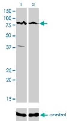 Western Blot: ALS2CR8 Antibody (2A3) [H00079800-M01]