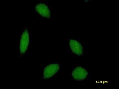 Immunocytochemistry/ Immunofluorescence: ALS2CR8 Antibody [H00079800-B01P]