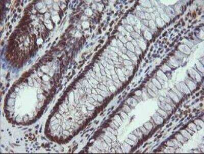 Immunohistochemistry-Paraffin: ALX4 Antibody (OTI6B3) [NBP2-45490]
