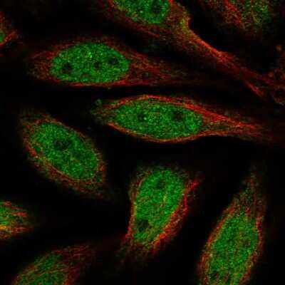 Immunocytochemistry/ Immunofluorescence: ALX4 Antibody [NBP2-55644]