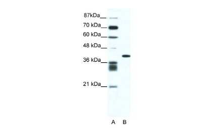 Western Blot: ALX4 Antibody [NBP2-86987]