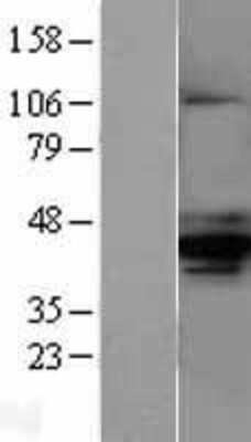 Western Blot: alpha-Methylacyl-CoA Racemase/AMACR Overexpression Lysate [NBL1-07494]