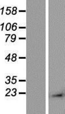 Western Blot: alpha-Methylacyl-CoA Racemase/AMACR Overexpression Lysate [NBP2-10123]