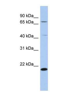 Western Blot: AMD1 Antibody [NBP1-54975]