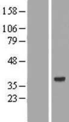 Western Blot: AMD1 Overexpression Lysate [NBP2-08187]