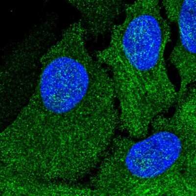 Immunocytochemistry/ Immunofluorescence: AMDHD1 Antibody [NBP1-82701]