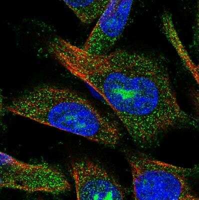 Immunocytochemistry/ Immunofluorescence: AMDHD2 Antibody [NBP1-84516]