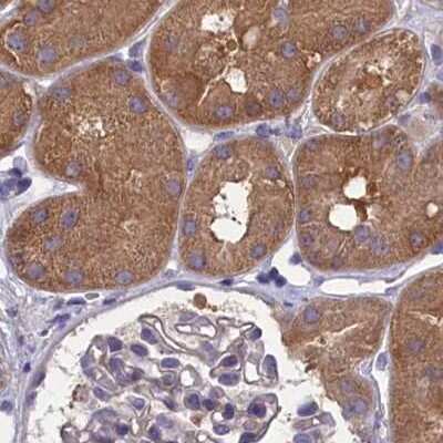 Immunohistochemistry-Paraffin: AMDHD2 Antibody [NBP1-84515]