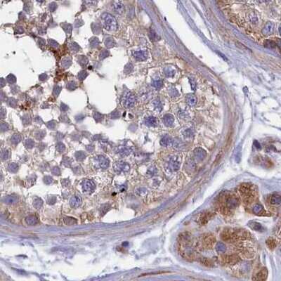 Immunohistochemistry-Paraffin: AMDHD2 Antibody [NBP1-84516]