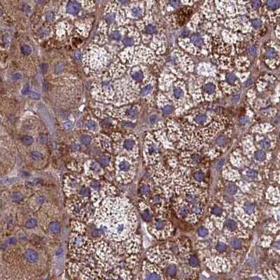 Immunohistochemistry-Paraffin: AMDHD2 Antibody [NBP1-84516]