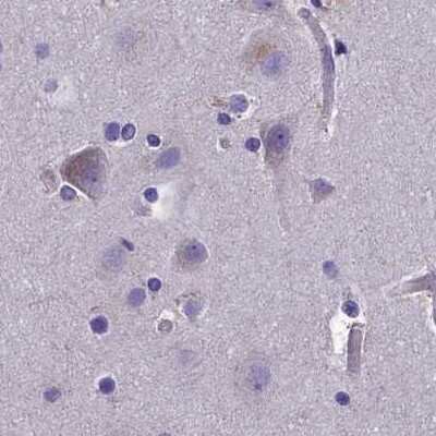 Immunohistochemistry-Paraffin: AMDHD2 Antibody [NBP1-84516]