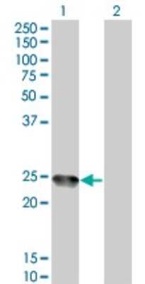 Western Blot: AMELX Antibody (6G3) [H00000265-M04]