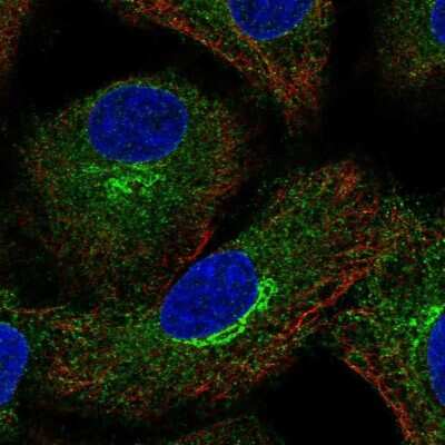 Immunocytochemistry/ Immunofluorescence: AMFR/gp78 Antibody [NBP2-57987]