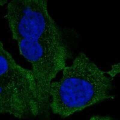 Immunocytochemistry/ Immunofluorescence: AMID Antibody [NBP3-17800]