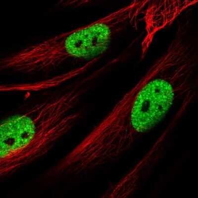 Immunocytochemistry/ Immunofluorescence: AMIGO Antibody [NBP2-14287]