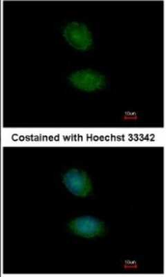 Immunocytochemistry/ Immunofluorescence: AMMECR1 Antibody [NBP2-15377]