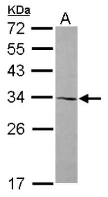 Western Blot: AMMECR1 Antibody [NBP2-15377]