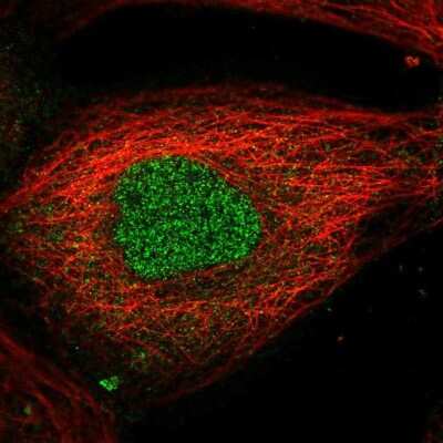 Immunocytochemistry/ Immunofluorescence: AMMECR1L Antibody [NBP2-58193]