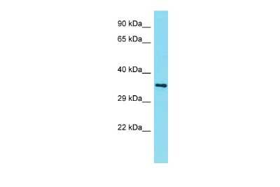 Western Blot: AMMECR1L Antibody [NBP2-82592]