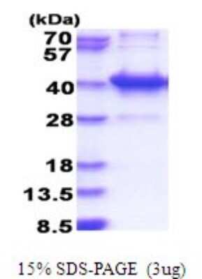 SDS-PAGE: Recombinant Human AMMECR1L His Protein [NBP2-51779]