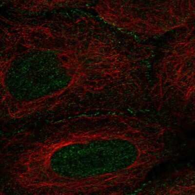 Immunocytochemistry/ Immunofluorescence: AMOT Antibody [NBP2-68862]
