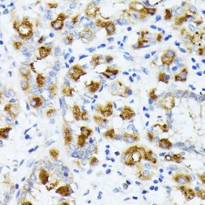 Immunohistochemistry-Paraffin: AMOTL2 Antibody - Azide and BSA Free [NBP2-92875]