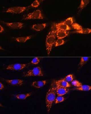 Immunocytochemistry/ Immunofluorescence: AMPD1 Antibody - BSA Free [NBP2-92427]