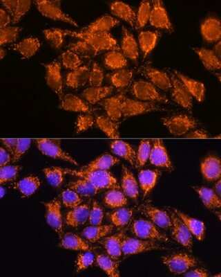 Immunocytochemistry/ Immunofluorescence: AMPD1 Antibody - BSA Free [NBP2-92427]