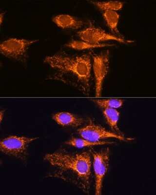 Immunocytochemistry/ Immunofluorescence: AMPD1 Antibody - BSA Free [NBP2-92427]