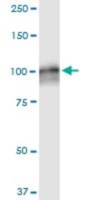 Western Blot: AMPD2 Antibody (6A8) [H00000271-M09]