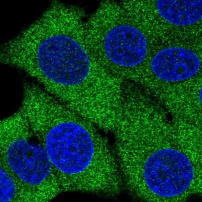 Immunocytochemistry/ Immunofluorescence: AMPD2 Antibody [NBP2-47549]