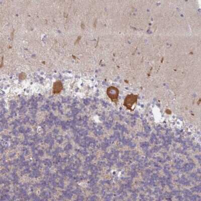 Immunohistochemistry-Paraffin: AMPD2 Antibody [NBP2-47549]