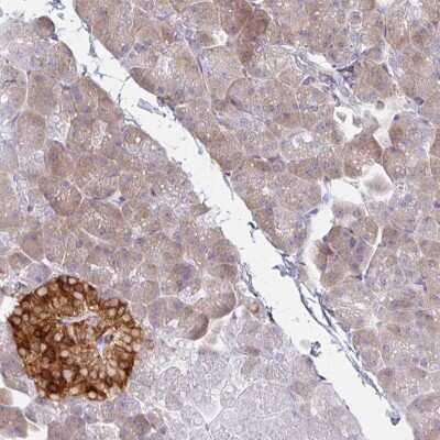 Immunohistochemistry-Paraffin: AMPD2 Antibody [NBP2-47549]