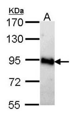 Western Blot: AMPD2 Antibody [NBP1-33698]
