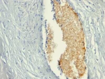 Immunohistochemistry-Paraffin: AMPD3 Antibody (AMPD3/901) [NBP2-44441]