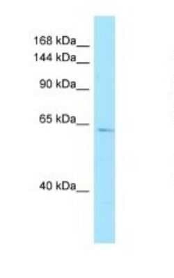 Western Blot: AMPD3 Antibody [NBP1-98543]