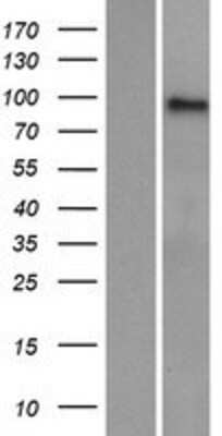 Western Blot: AMPD3 Overexpression Lysate [NBP2-09021]