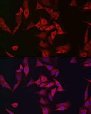 Immunocytochemistry/ Immunofluorescence: AMPK alpha 1/2 Antibody - Azide and BSA Free [NBP3-05628]
