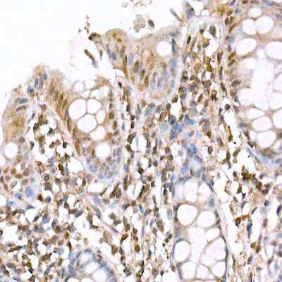 Immunohistochemistry-Paraffin: AMPK alpha 1/2 Antibody - Azide and BSA Free [NBP3-05628]