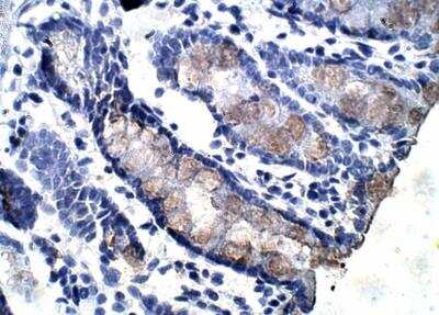 Immunohistochemistry-Paraffin: AMPK alpha 1/2 Antibody [NBP3-12281]