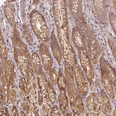 Immunohistochemistry: AMPK alpha 1 Antibody [NBP2-49430]
