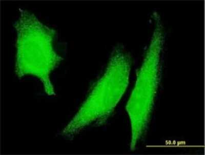 Immunocytochemistry/ Immunofluorescence: AMPK alpha 2 Antibody (1G8) [H00005563-M02]