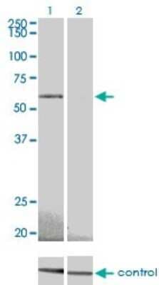 Western Blot: AMPK alpha 2 Antibody (1G8) [H00005563-M02]